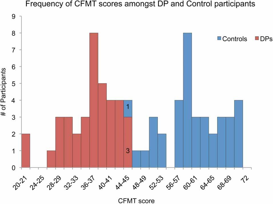 DEGUTIS ET AL. Figure 3. Frequency of Cambridge Face Memory Test (CFMT) scores amongst DP (developmental prosopagnosics) and control participants. http://dx.doi.org/10.1080/02643294.2012.