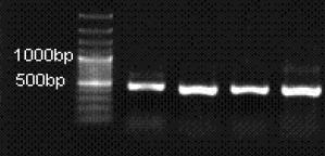 Ranjbar R. et al 303 PCR products were visualized by electrophoresis in 1.5% agarose gels stained with ethidium bromide.
