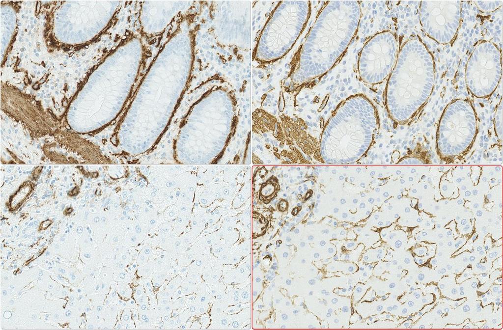 IHC Protocols and controls for Breast tumours Breast panel: ASMA Ventana BenchMark Basic protocol settings for an optimal staining result (NQC) Retrieval Titre Detection