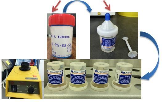 ParaTest (Kit) for Fecal Examination for Intestinal Parasites Principle A new way of doing Natural Sedimentation Technique using 4ml of 5% buffered