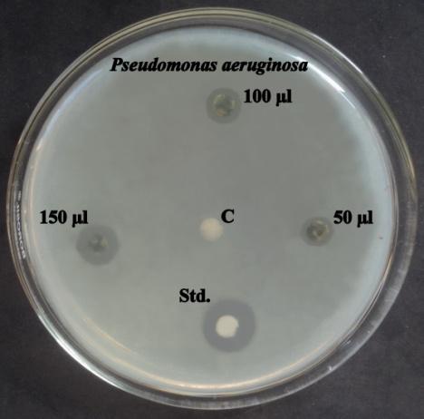 Streptococcus pyogenes