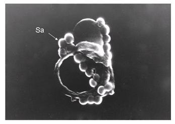 Figure 3a Figure 3b Figure 3: Scanning electron micrograph showing (a) adherence of live S. aureus (Sa) (x 8,500) and (b) non-adherence of dead S. aureus (Sa), to human sperm (x 2,700) The dead S.
