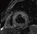 which has proven to make imaging this area