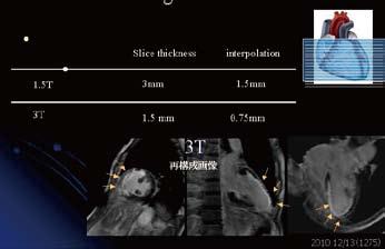 Initial clinical experience of TOSHIBA 3T MRI Furthermore, both FBI and Time- SLIP methods can be used to extract very fine detail from 3T MRI when using non-contrast