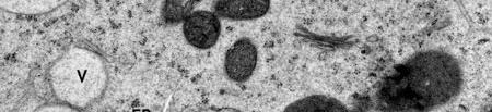 Cytoplasm Jellylike material found