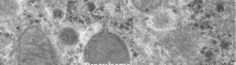 Peroxisomes Similar to lysosomes but contain