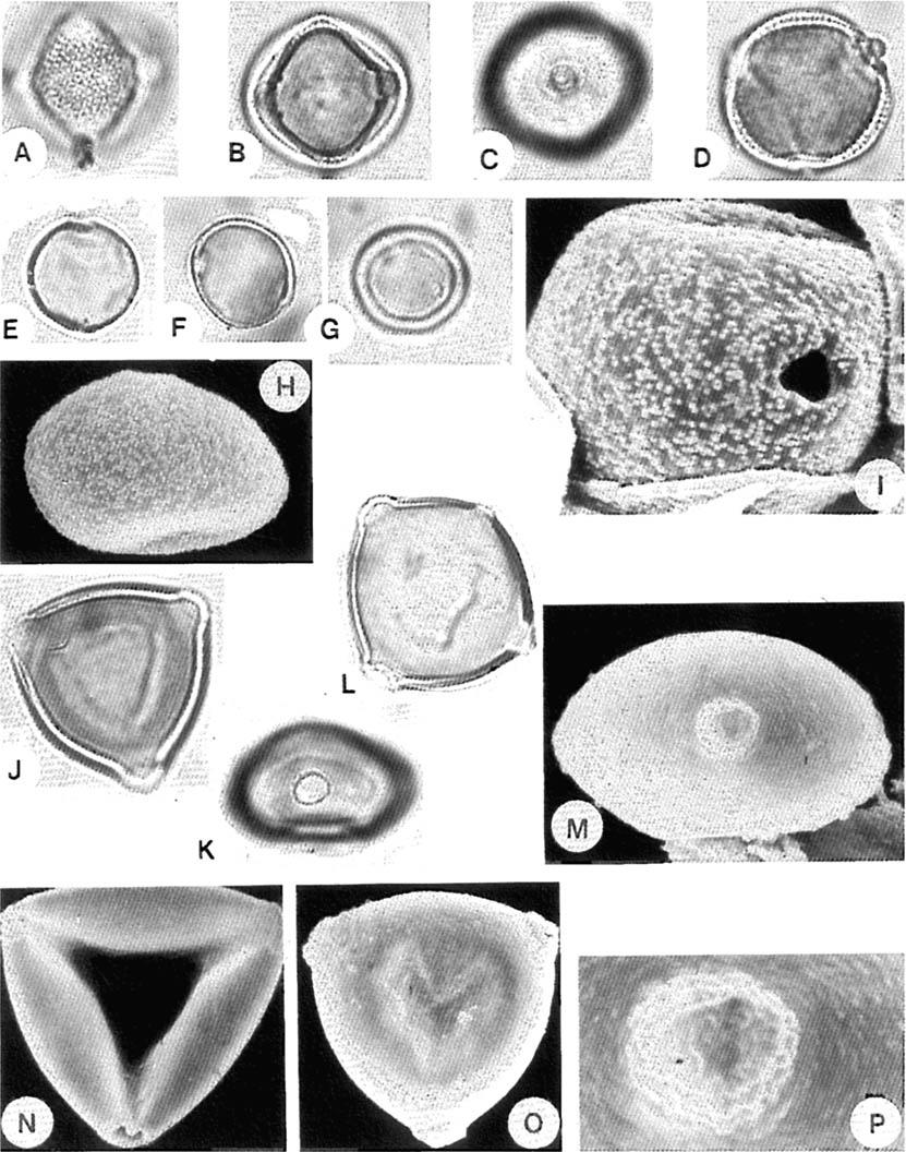 Fig. I I. hlimosaceae. A-D. Fipradeniasrriiiiz africaiziiin. (C) distinct annulus (D) note operculum of 0s. hlonceae. E-I. Morris ii~esozjgin. (H) two pores, x 1000.