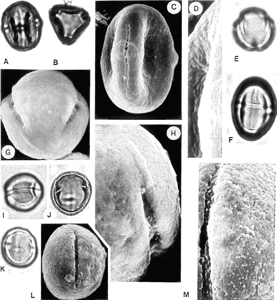 126 M. A. Soininnti Fig. 5. Burseraceae. A-D. Cariariirm sclnreinfctrthii. (C) x SOOO. E- 1. Dacryodes edttlis. (G) x 3000. (H) note granular colpus membrane x 6000. I-hl. Saritiria trinieriu.
