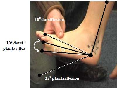 Primary Criterion #5 Less than or equal to 10 ankle dorsi / plantar flexion available in the range between 10 dorsiflexion and 25 plantar flexion. The test is conducted with the knee in 90.