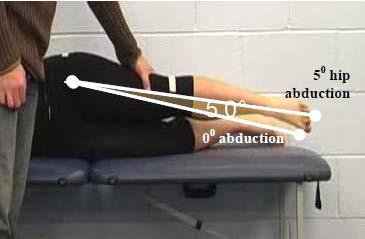 Primary Criterion #3 Hip Abduction loss of 3 muscle grade points (muscle grade of two).