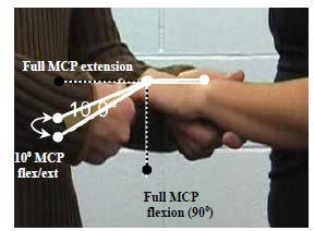 Criterion #6 any four digits with 10 of flexion / extension at the metacarpo-phalangeal joint.