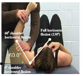 Criterion #2 Shoulder Horizontal Flexion loss of 3 muscle grade points (i.e., muscle grade of two).
