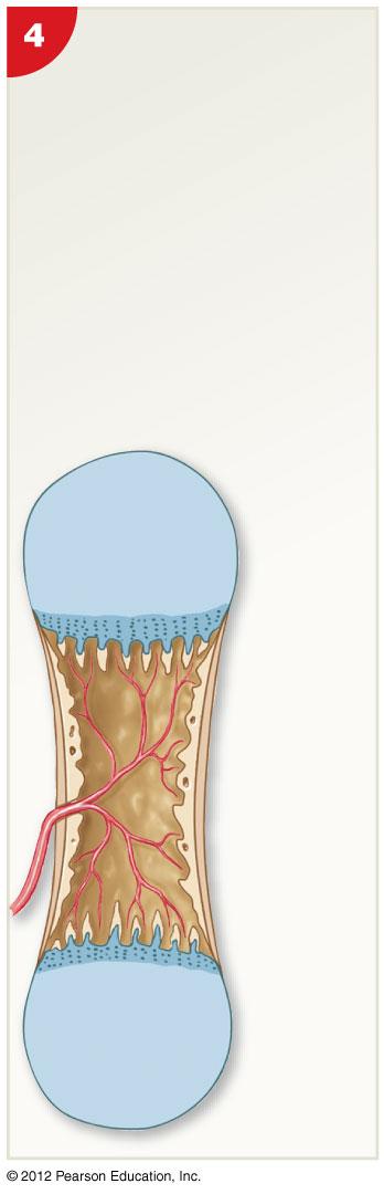 Remodeling Medullary cavity
