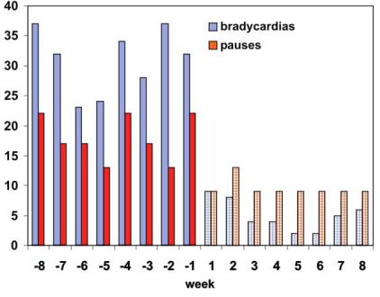 Positive effect of CPAP on bradyarrhythmias in
