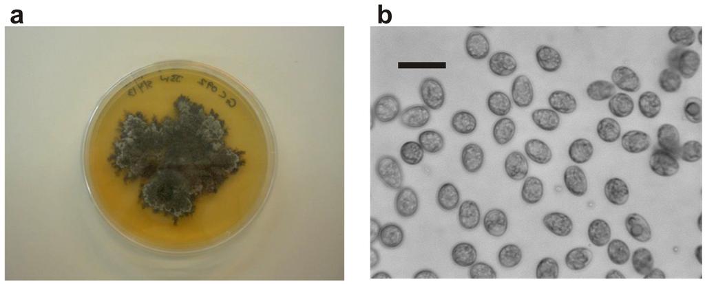 infected oranges. The aim of this was to determine how long conidia were produced for during a light rain shower. Figure 6 (a). Phyllostica citricarpa colony on a PDA agar plate; (b). P. citricarpa conidia in aqueous suspension (bar represents 10 mm).