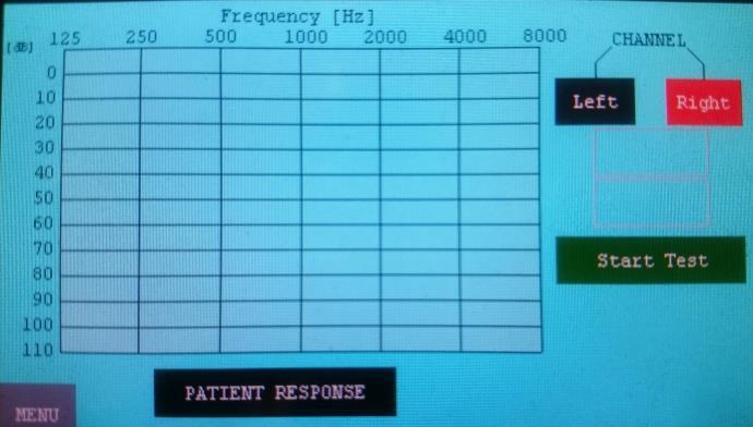 There are audiogram chart, channel selection buttons, frequency and volume indicators and patient response button on the automatic test screen (Figure 3.3). Figure 3.3: Automatic test screen.