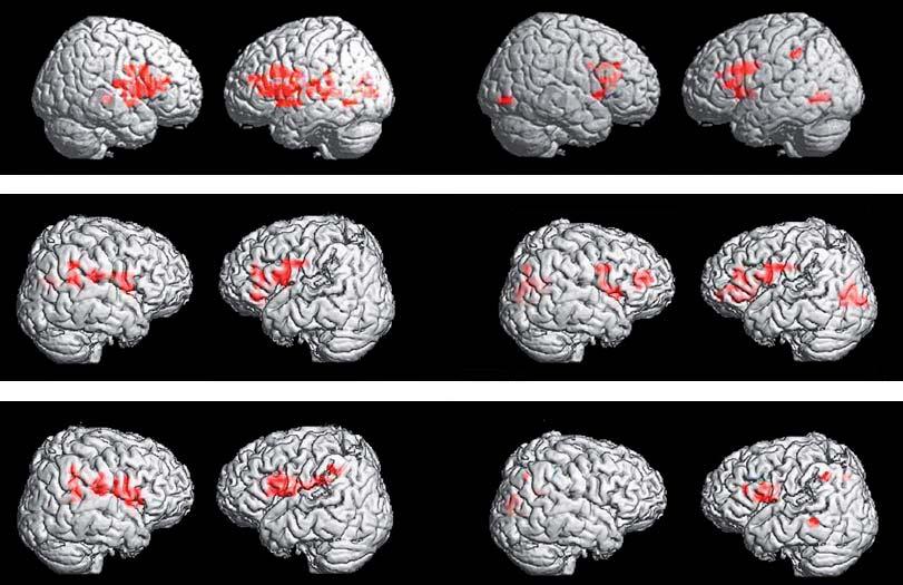 Neuro-imaging data: Naming