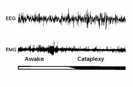 30 Figure 1.10: This figure represents an episode of cataplexy in narcoleptic mice under EEG and EMG.
