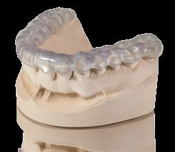 Splints VarseoWax Splint The resin for 3D printing of occlusal and bruxism splints The resin's excellent flow properties produce a dense surface and high level of impact strength for guaranteed