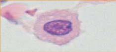 (PAMPS)) -Innate Immune Response (Immune cells,