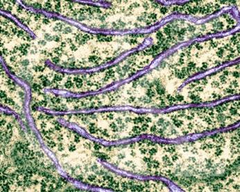 Endoplasmic Reticulum The ER is a twisting network of canals and sacs extending through the cytoplasm and connecting the cell membrane to