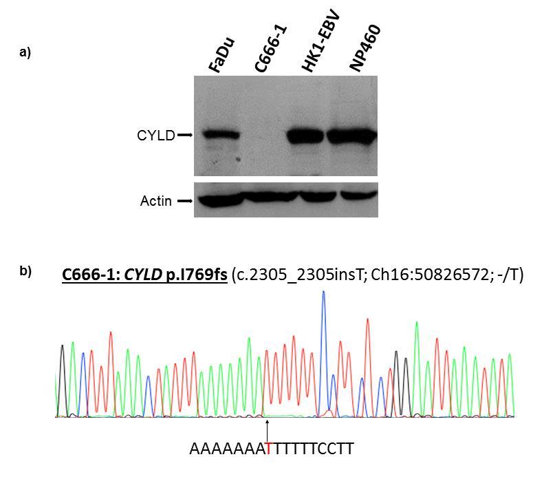 Supplementary Figure 10. CYLD p.i769fs mutation resulting in loss of CYLD protein in an NPC cell line, C-6661.