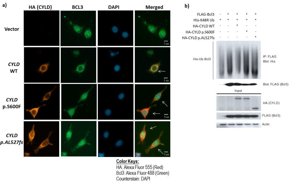 Supplementary Figure 12. Wild type CYLD inhibited nuclear translocation of BCL3 in NPC cells.