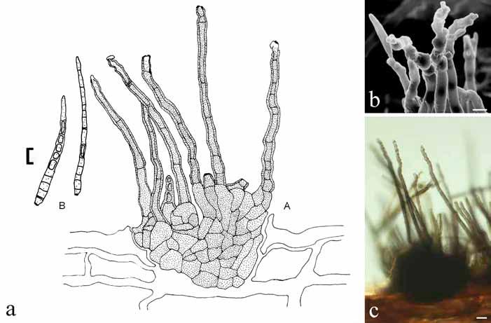 Cercosporoid fungi 1 Fig. 26. Passalora pyrrosiae (TFM : FPH-7852). a. Drawing (A. Conidiophore fascile, B. Conidia). b. Micrograph of conidiophores (SEM). c. Micrograph of conidiophores (light microscopy).
