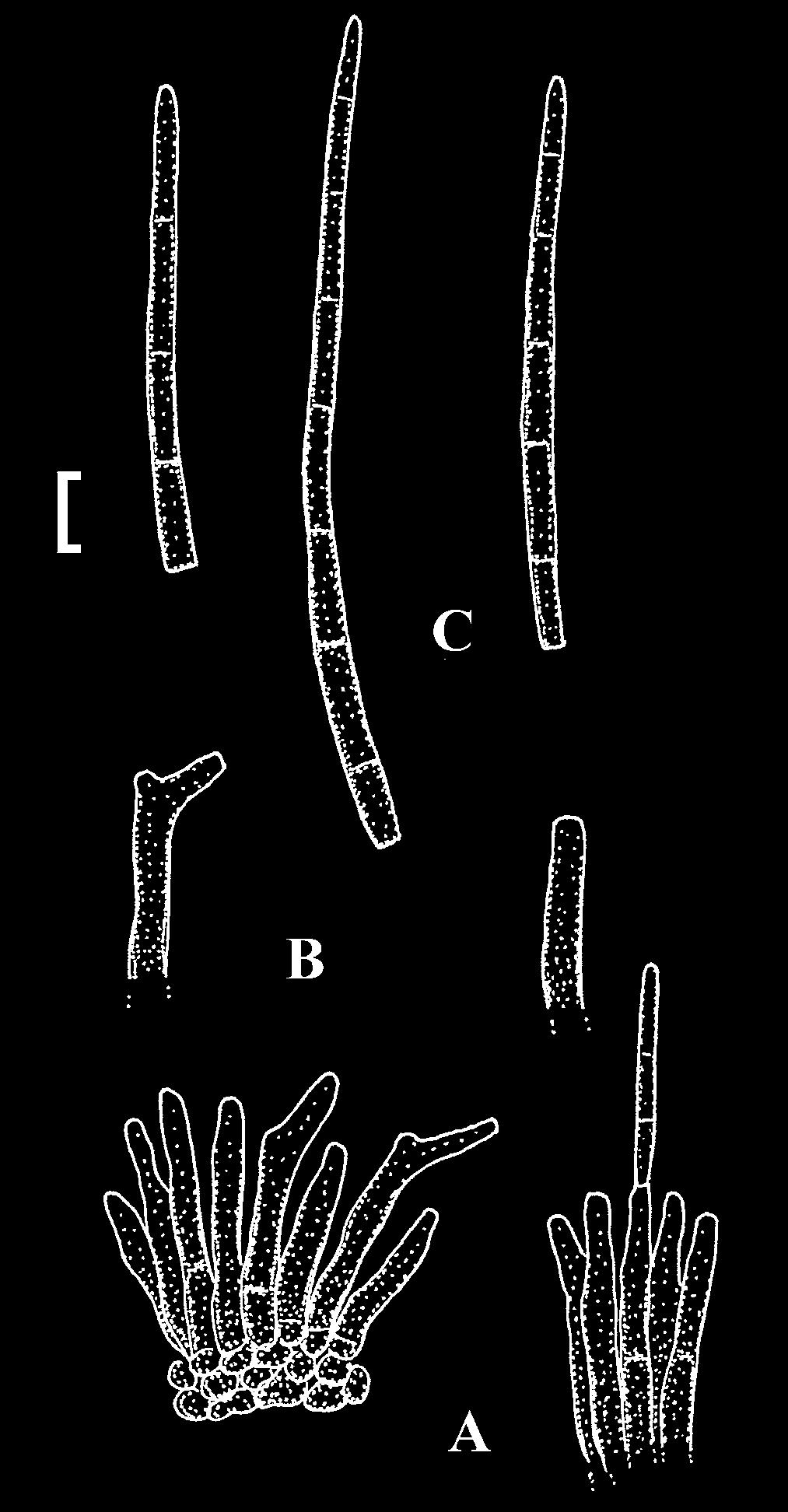 Braun et al. a b c Fig. 33. Pseudocercospora cyatheae (NBRC-H-12398). a. drawing (A. Conidiophore fascicle, B. Conidia, U. Braun del.). b. Conidium (light microscopy). c. Conidiophore fascicle (light microscopy).