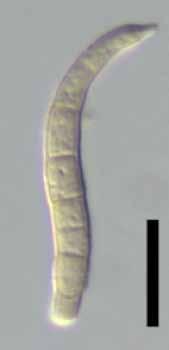 percurrent, conidiogenous loci inconspicuous, unthickened, not darkened or rim-like. Conidia solitary, cylindrical to obclavate, mildly curved to sigmoid, 30 50 3.5 5.