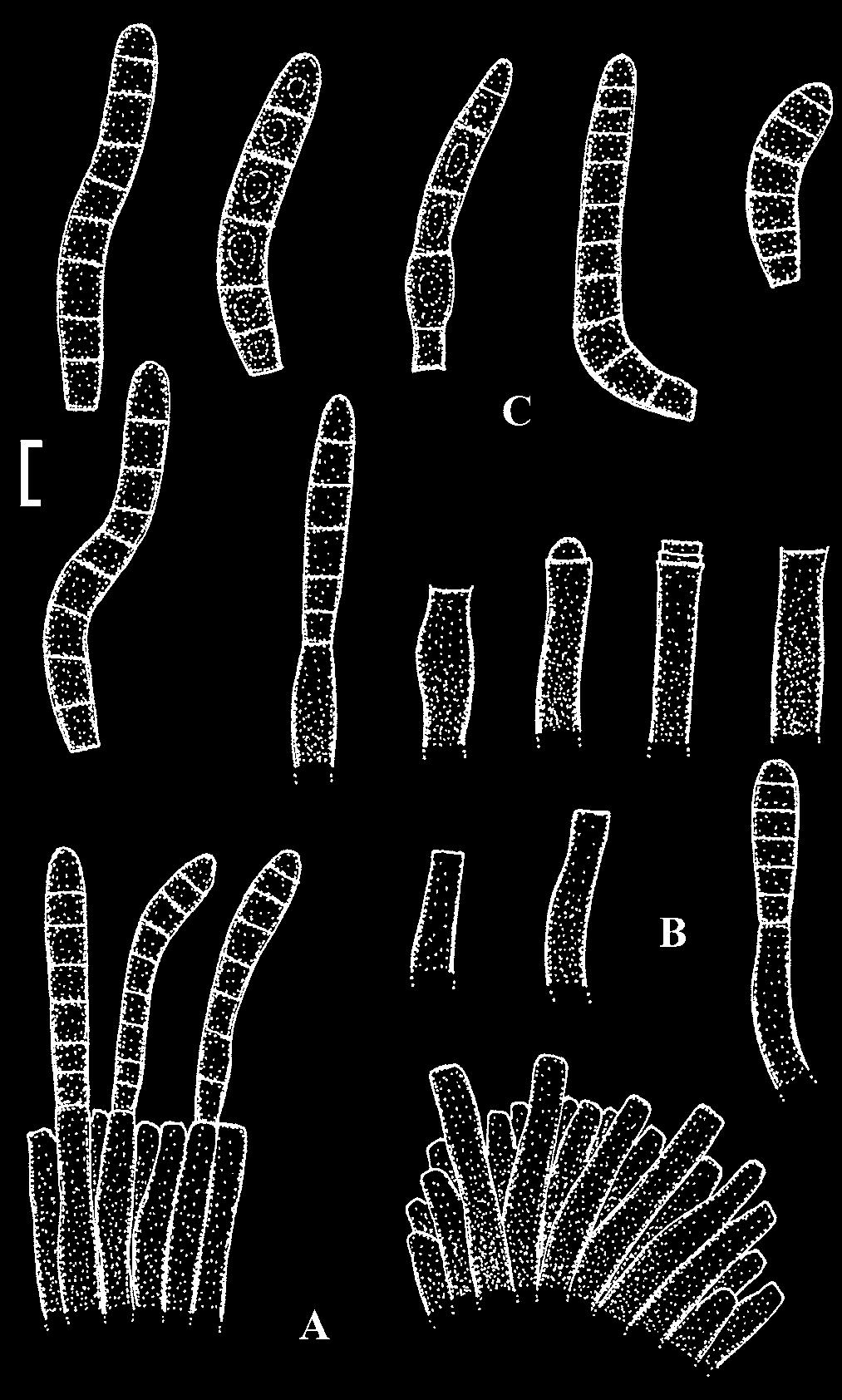 Cercosporoid fungi 1 a b Fig. 66. Pseudocercospora sciadopytios (TFM:FPI-4757). a. Conidium (light microscopy). b. Conidiophore fascicle (light microscopy). Bars = 5 µm (a) and 10 µm (b).