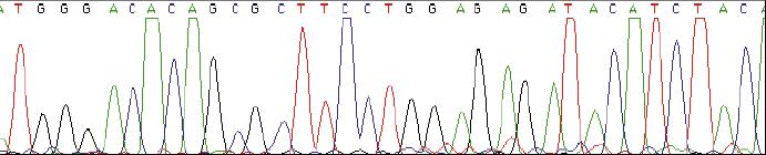 Genotypic Assay Dideoxyterminator Sequencing Nucleotide sequence result CCTCAGATCACTCTTTGGCAACGACCCATAGTCACAATAAAGATAGCGGGACAACTAAAGGAAGCTCTATTAGATACAGGAGCAGATG