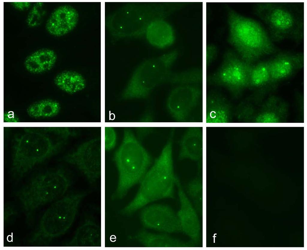 Autoimmune sera that immunoprecipitate D-E-F-G proteins stain Cajal body in immunofluorescence Human anti-sm mouse mab