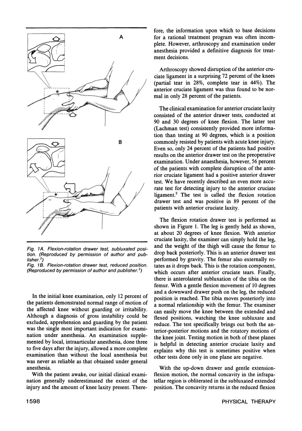 Fig. 1A. Flexion-rotation drawer test, subluxated position. (Reproduced by permission of author and publisher. 2 ) Fig. 1B. Flexion-rotation drawer test, reduced position.