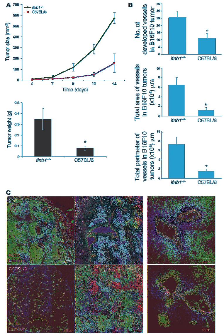 research article Figure 1 Enhanced tumor growth and angiogenesis in Ifnb1 / mice. (A) Growth and size of tumors are significantly higher in Ifnb1 / mice. B16F10 melanoma cells were injected s.c. into the abdomen of C57BL/6 or Ifnb1 / mice, and tumor growth was monitored.
