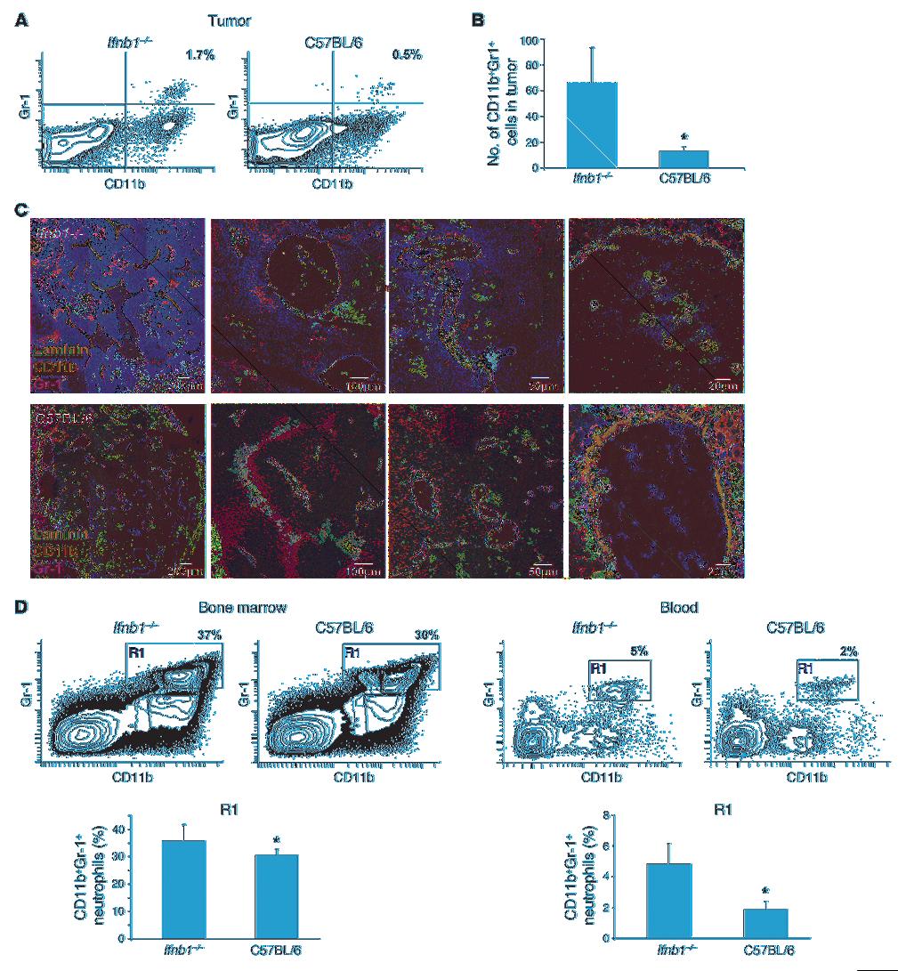 research article Figure 3 Enhanced numbers of CD11b+Gr-1+ neutrophils in tumors of Ifnb1 / mice.