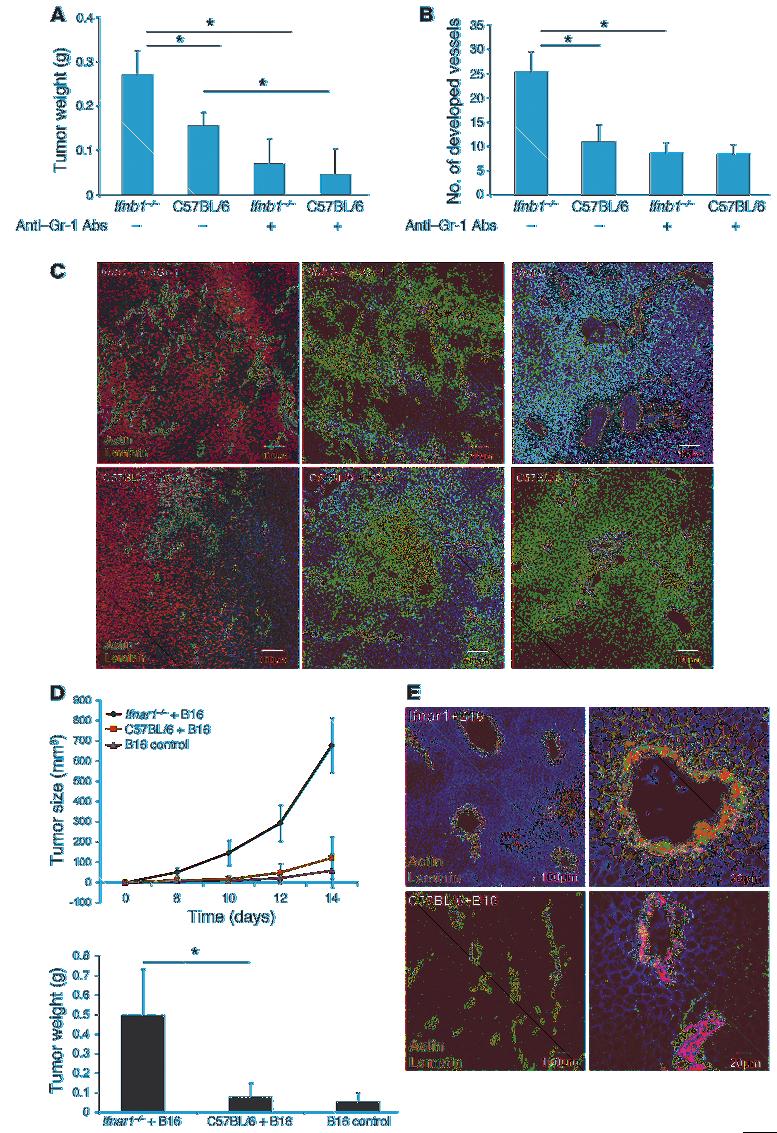 research article Figure 4 Essential role of IFN-β responsive CD11b+Gr1+ neutrophils in B16F10 tumor growth and angiogenesis.