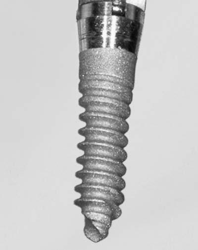 The Dual-Top (Jeil Medical Corporation, Seoul, Korea) is a machined pure titanium (MT), self tapping, threaded mini-implant available in diameters of 1.4, 1.6, and 2.0 mm and in lengths of 6.0, 8.