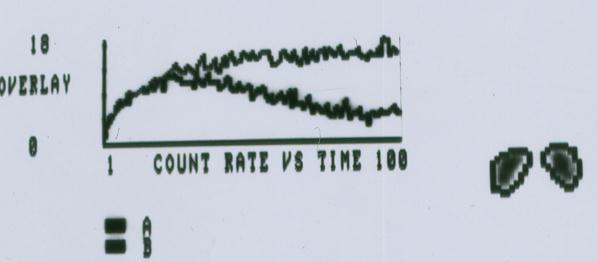 Radihistogram: time-activity curve computer programs: algorithm