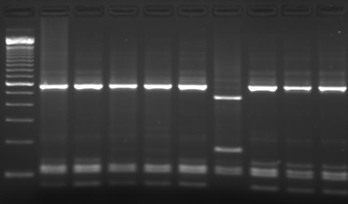 Molecular marker (M) is indicated on each gel and the key base pair sizes labeled (100, 300, and 600) Following Ssp1 and Vsp 1 digestion of the secondary amplicon, they produce banding pattern of