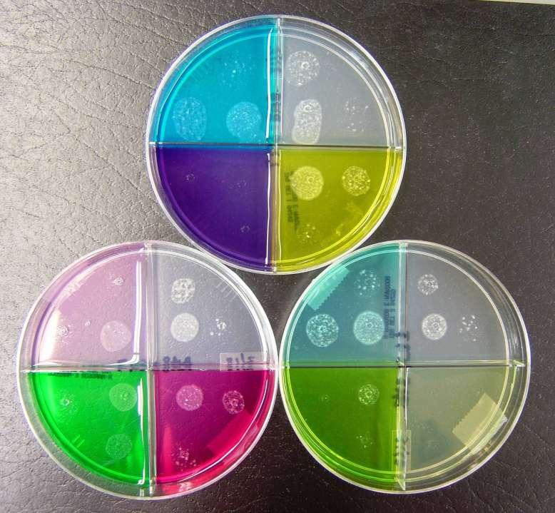 Agar Plate Method for primary confirmation and second line antituberculous Drugs Gold