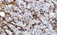 Basic stain: Immunoglobulin IHC-Ig first protocol for IHC in FFPE still one of the hardest to perform & evaluate!