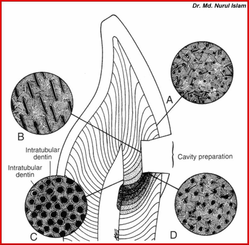 Cavity Preparation The size, curvature and distance between tubules in outer, mid, and inner surface of dentin The dentinal tubules are sigmoid ( S ) shape curved structure which run perpendicularly