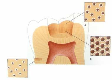 Cavity Preparation The number of dentinal tubules