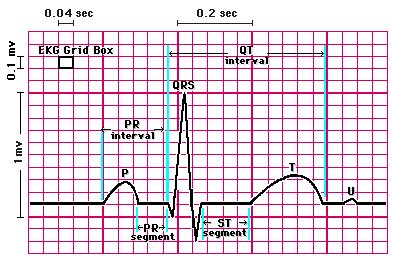 Approach to EKG Interpretation Rate Rhythm Axis