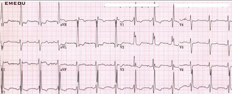 Case 5: This patient is asymptomatic and had a Welcome to