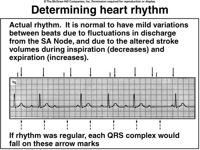 Interpretation of ECG Normal heart rhythm has consistent