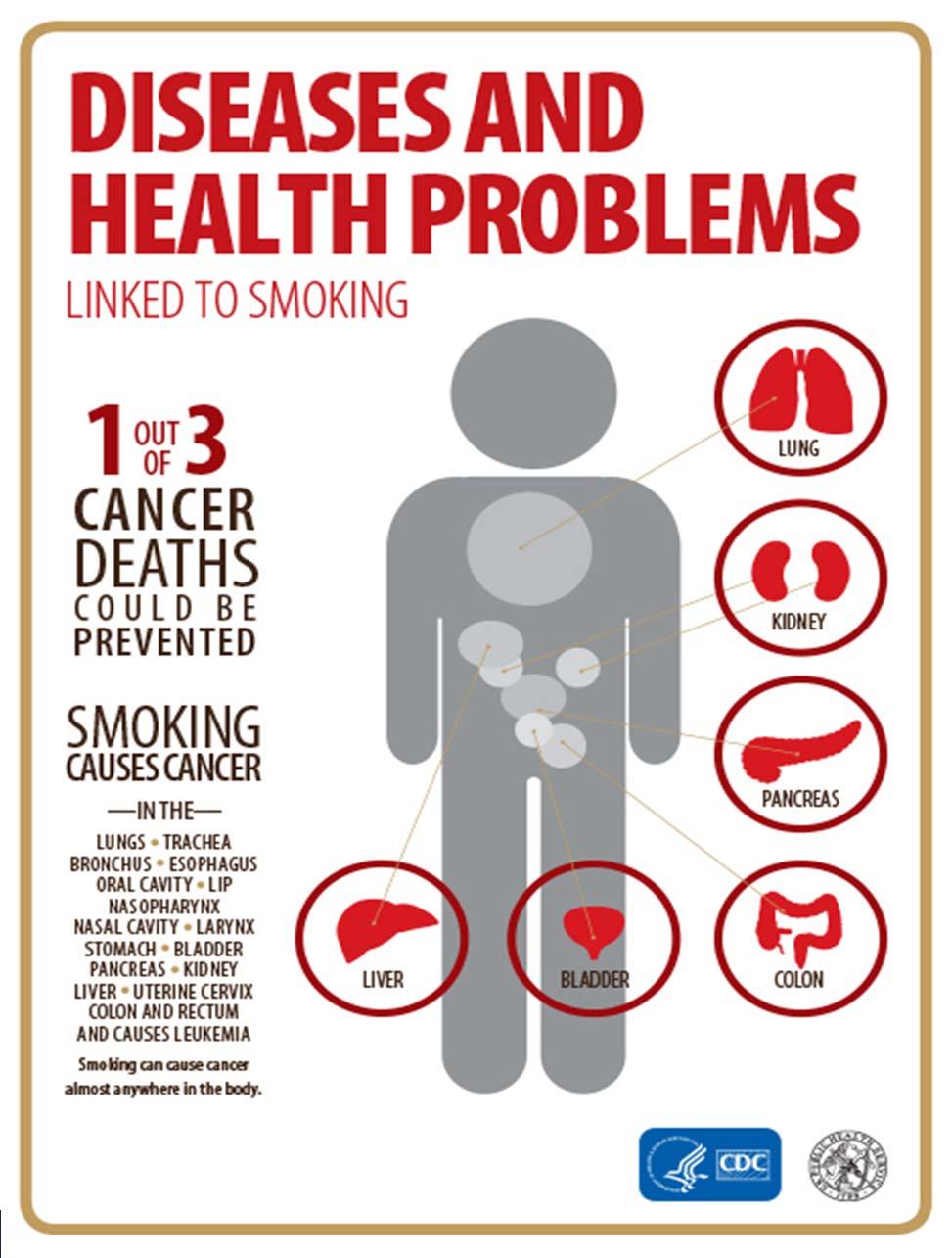Dangers of Tobacco Use Lung and Bronchus Cancers