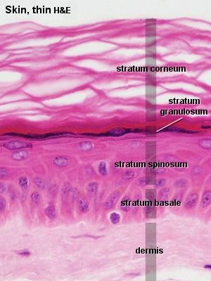 Skin, thick L Low magnification view of thick