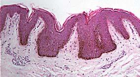 Dermis Thick connective tissue layer underlying epidermis Basement membrane mediates attachment of epidermis to dermis Epidermal cells of stratum basale anchored to
